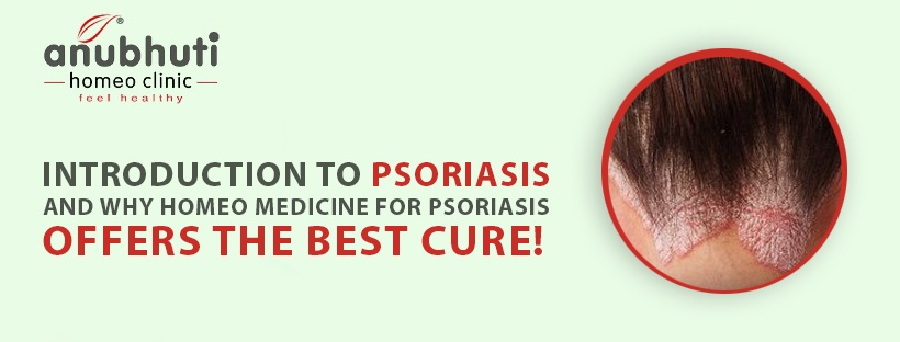 Psoriasis